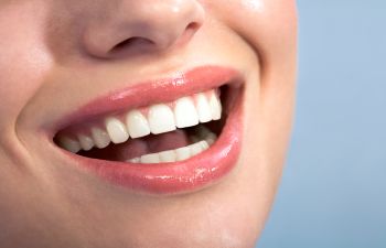 Porcelain Veneers New Braunfels TX